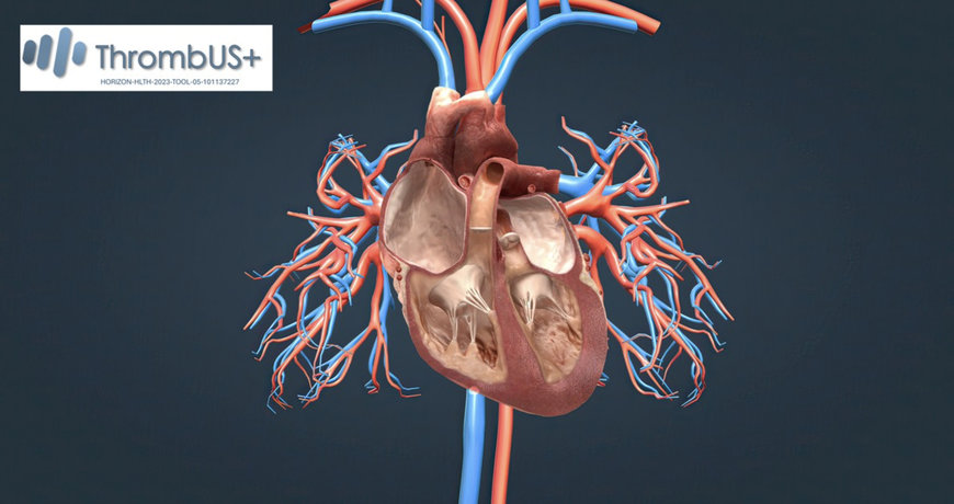 FRAUNHOFER IPMS: EU PROJECT DEVELOPS PORTABLE DIAGNOSTIC DEVICE FOR EARLY DETECTION OF DEEP VEIN THROMBOSIS